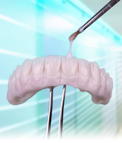 in-house dental lab fabrication of a all on 4 prosthesis