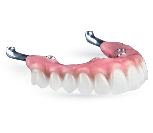 all on 4 fixed hybrid denture in mexico