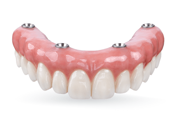 all on 4 permanent dental prosthesis