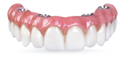 fixed hybrid all on 4 denture cost in mexico