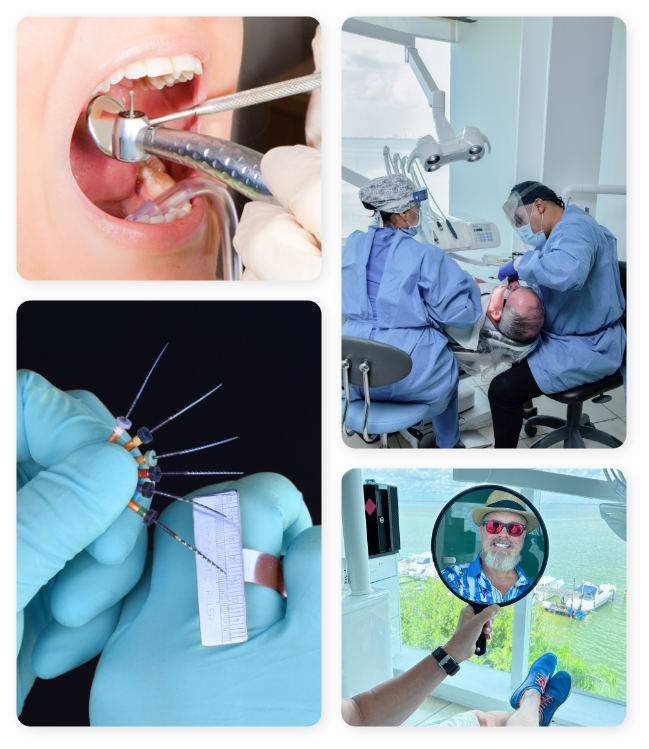 root canal therapy in mexico at ocean dental