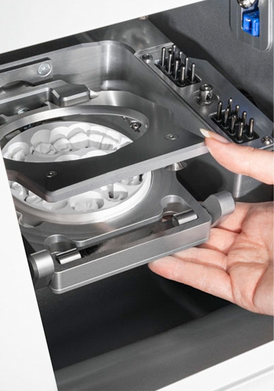 in-house fabrication of dental inlays and onlays