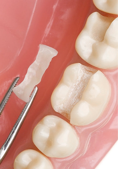 in-house fabrication of dental