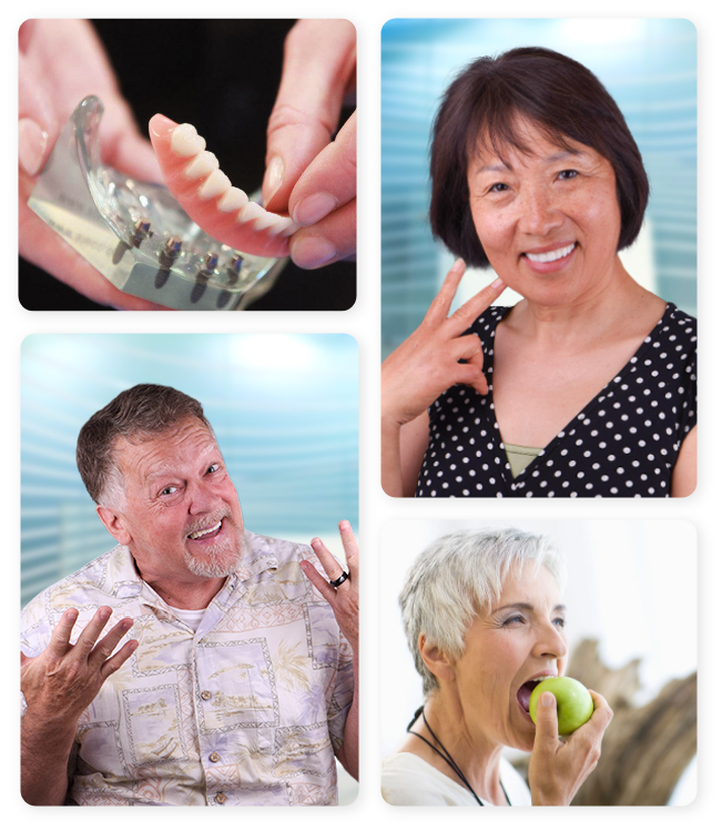 Snap In Dentures MEXICO ┇Costs┇BEFORE & AFTER