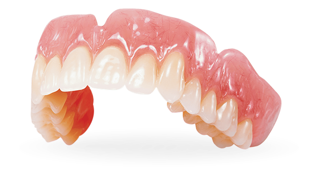 upper snap on denture fabricated with PMMA