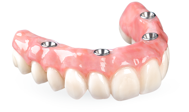 full arch all on 4 zirconia bridge prosthesis