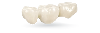 cost of 3 unit-dental bridges in Mexico