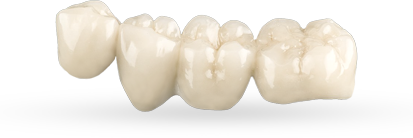 cost of 4 unit dental bridges in Mexico
