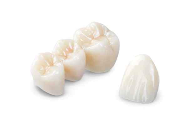 cancun dental crowns