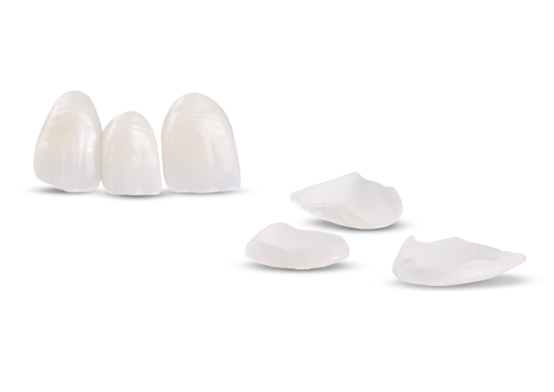 cancun dental veneers