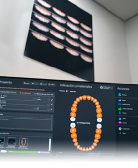 Digital smile design software used by dentists in Cancun for full-mouth restorations