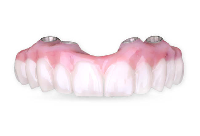 All on 4 prosthesis used for full mouth restoration in Cancun