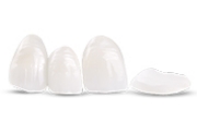 dental crowns and bridges, treatment involved in full mouth reconstruction