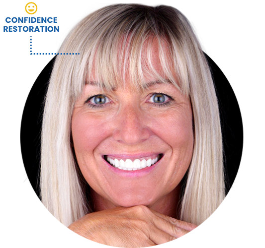 Middle age blond woman smiling with confidence after getting full-mouth reconstruction in Mexico