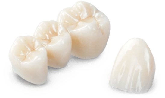 porcelain crowns and bridges in Mexico