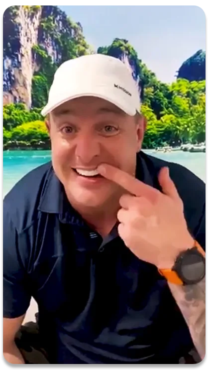 gentleman showing his dental implants