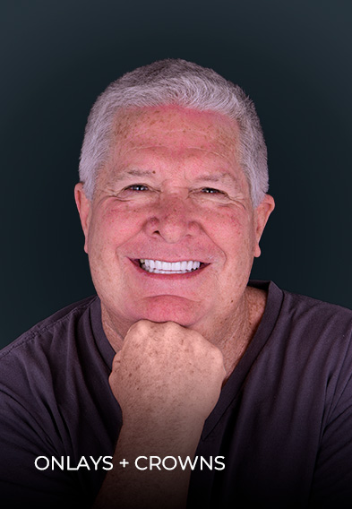 smiling after getting dental onlays and onlays in Mexico