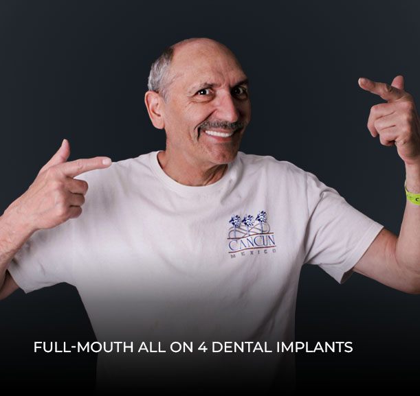patient showing his full-arch restoration with all on 4 dental implants
