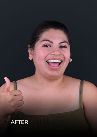 patient at ocean dental cancun after her teeth whintening session
