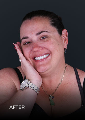 patient of Dental Work Mexico, smiling after her full-mouth restoration with crowns and bridges