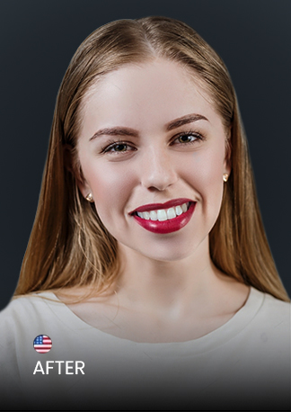 Ocean Dental Cancun patient after her treatment with braces in Mexico