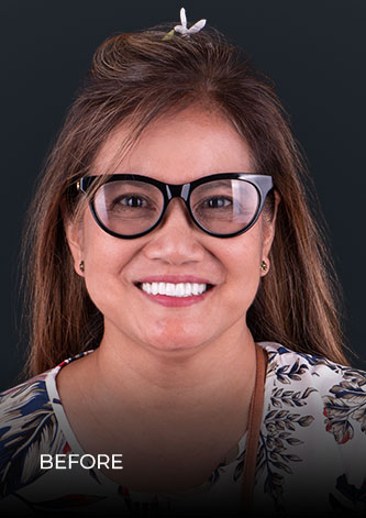 dental work mexico patient smiling after getting her dental bridge
