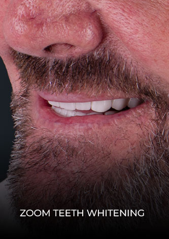 Patient close up picture of his smile after getting a zoom whitening procedure