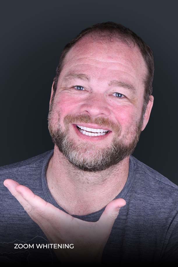 Patient at ocean dental cancun after getting his professional teeth whitening treatment in Mexico