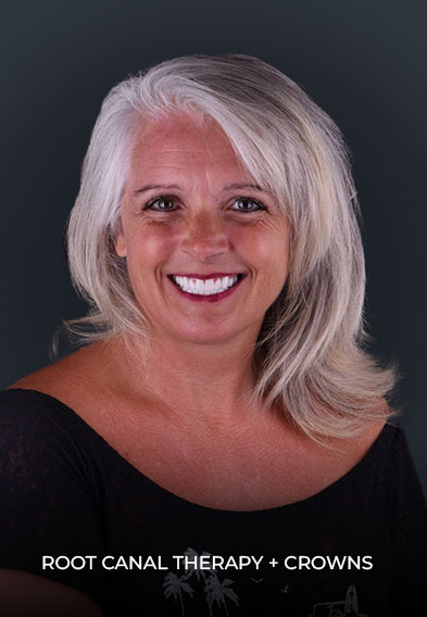 picture of ocean dental mexico patient after getting root canal therapy