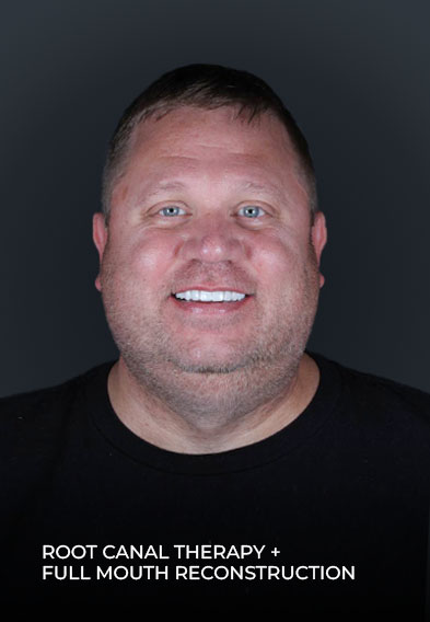 picture of ocean dental mexico patient after getting root canal therapy