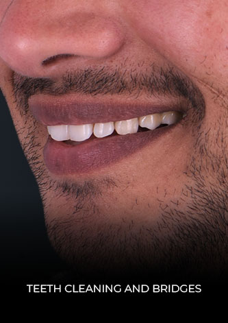 Patient close up after getting a deep teeth cleaning